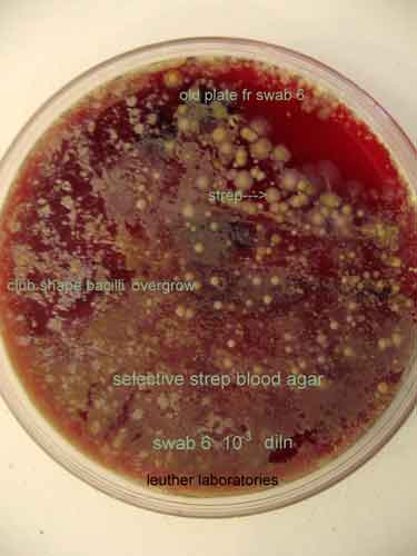 bacteria testing slide by Leuther Laboratory, Microbiological analysis lab near La Crosse, WI